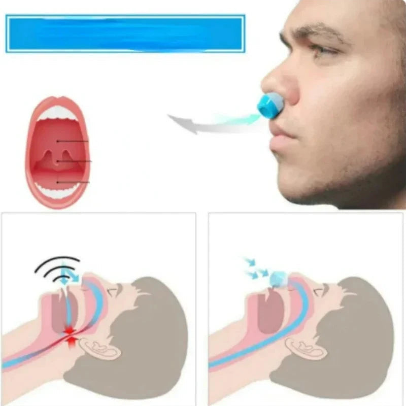 2-in-1 Anti-Snore Device & Nasal Air Purifier Nose Clip – Magnetic Nasal Dilator & Air Filter Clip for Better Airflow & Quieter Sleep